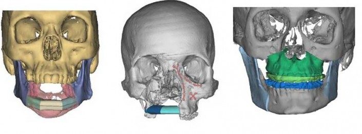 3D Systems Acquires Medical Modelling – Objex Unlimited