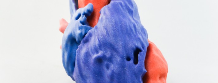 CT Scan of Human Heart. Printed on ProJet® 4500 by Objex Unlimited.