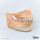 CT Scan of Human Teeth. Printed on a ProJet 4500 by Objex Unlimited.